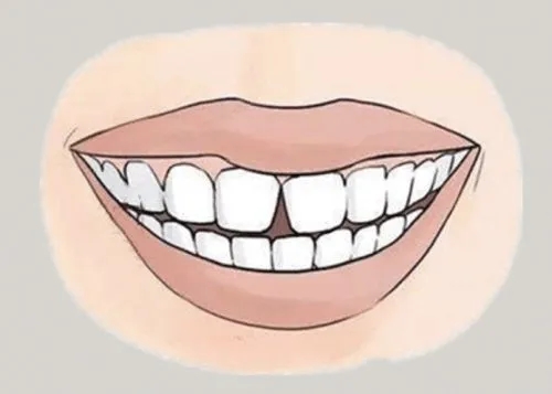 <a href=http://m.jjspa.com.cn/news_article?news_id=116>一次性口腔探針</a>